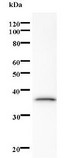 SAE1 Antibody - Western blot of immunized recombinant protein using SAE1 antibody.