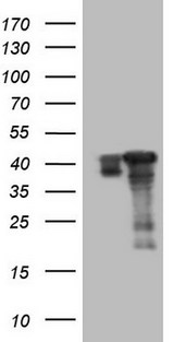 SAE1 Antibody - HEK293T cells were transfected with the pCMV6-ENTRY control (Left lane) or pCMV6-ENTRY SAE1 (Right lane) cDNA for 48 hrs and lysed. Equivalent amounts of cell lysates (5 ug per lane) were separated by SDS-PAGE and immunoblotted with anti-SAE1.