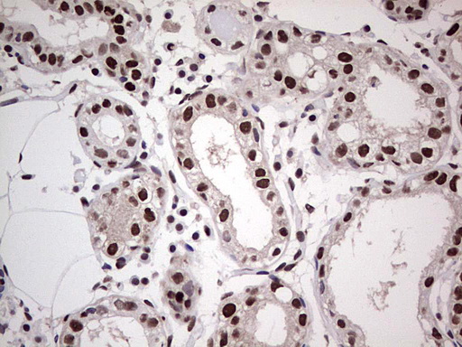 SAE1 Antibody - Immunohistochemical staining of paraffin-embedded Human breast tissue within the normal limits using anti-SAE1 mouse monoclonal antibody. (Heat-induced epitope retrieval by 1 mM EDTA in 10mM Tris, pH8.5, 120C for 3min,