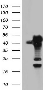 SAE1 Antibody - HEK293T cells were transfected with the pCMV6-ENTRY control. (Left lane) or pCMV6-ENTRY SAE1. (Right lane) cDNA for 48 hrs and lysed. Equivalent amounts of cell lysates. (5 ug per lane) were separated by SDS-PAGE and immunoblotted with anti-SAE1.