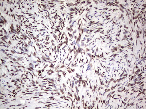 SAE1 Antibody - Immunohistochemical staining of paraffin-embedded Human Ovary tissue within the normal limits using anti-SAE1 mouse monoclonal antibody. (Heat-induced epitope retrieval by 1 mM EDTA in 10mM Tris, pH8.5, 120C for 3min,