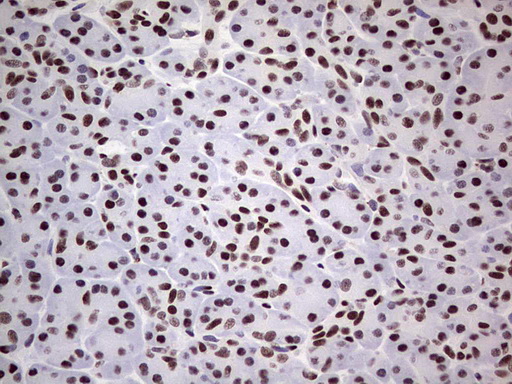 SAE1 Antibody - Immunohistochemical staining of paraffin-embedded Human pancreas tissue within the normal limits using anti-SAE1 mouse monoclonal antibody. (Heat-induced epitope retrieval by 1 mM EDTA in 10mM Tris, pH8.5, 120C for 3min,