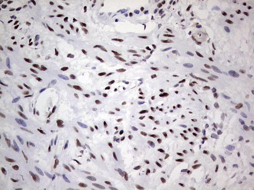 SAE1 Antibody - Immunohistochemical staining of paraffin-embedded Human endometrium tissue within the normal limits using anti-SAE1 mouse monoclonal antibody. (Heat-induced epitope retrieval by 1 mM EDTA in 10mM Tris, pH8.5, 120C for 3min,