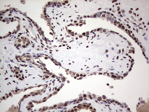 SAE1 Antibody - Immunohistochemical staining of paraffin-embedded Human prostate tissue within the normal limits using anti-SAE1 mouse monoclonal antibody. (Heat-induced epitope retrieval by 1 mM EDTA in 10mM Tris, pH8.5, 120C for 3min,