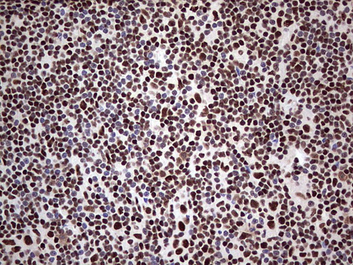 SAE1 Antibody - Immunohistochemical staining of paraffin-embedded Human lymph node tissue within the normal limits using anti-SAE1 mouse monoclonal antibody. (Heat-induced epitope retrieval by 1 mM EDTA in 10mM Tris, pH8.5, 120C for 3min,