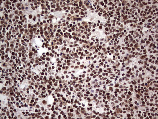 SAE1 Antibody - Immunohistochemical staining of paraffin-embedded Human tonsil within the normal limits using anti-SAE1 mouse monoclonal antibody. (Heat-induced epitope retrieval by 1 mM EDTA in 10mM Tris, pH8.5, 120C for 3min,