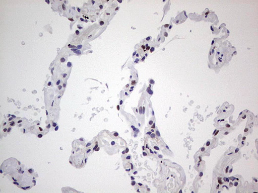 SAE1 Antibody - Immunohistochemical staining of paraffin-embedded Human lung tissue within the normal limits using anti-SAE1 mouse monoclonal antibody. (Heat-induced epitope retrieval by 1 mM EDTA in 10mM Tris, pH8.5, 120C for 3min,