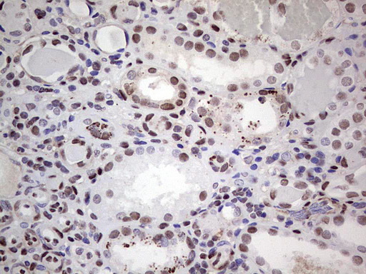 SAE1 Antibody - IHC of paraffin-embedded Human Kidney tissue using anti-SAE1 mouse monoclonal antibody. (Heat-induced epitope retrieval by 1 mM EDTA in 10mM Tris, pH8.5, 120°C for 3min).