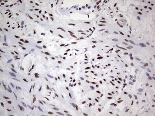 SAE1 Antibody - IHC of paraffin-embedded Human endometrium tissue using anti-SAE1 mouse monoclonal antibody. (Heat-induced epitope retrieval by 1 mM EDTA in 10mM Tris, pH8.5, 120°C for 3min).