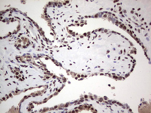 SAE1 Antibody - IHC of paraffin-embedded Human prostate tissue using anti-SAE1 mouse monoclonal antibody. (Heat-induced epitope retrieval by 1 mM EDTA in 10mM Tris, pH8.5, 120°C for 3min).