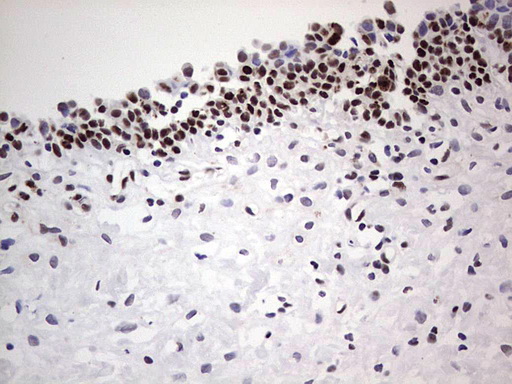 SAE1 Antibody - IHC of paraffin-embedded Human bladder tissue using anti-SAE1 mouse monoclonal antibody. (Heat-induced epitope retrieval by 1 mM EDTA in 10mM Tris, pH8.5, 120°C for 3min).