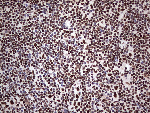 SAE1 Antibody - IHC of paraffin-embedded Human lymph node tissue using anti-SAE1 mouse monoclonal antibody. (Heat-induced epitope retrieval by 1 mM EDTA in 10mM Tris, pH8.5, 120°C for 3min).