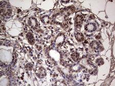 SAE1 Antibody - Immunohistochemical staining of paraffin-embedded Human breast tissue within the normal limits using anti-SAE1 mouse monoclonal antibody. (Heat-induced epitope retrieval by 1 mM EDTA in 10mM Tris, pH8.5, 120C for 3min,