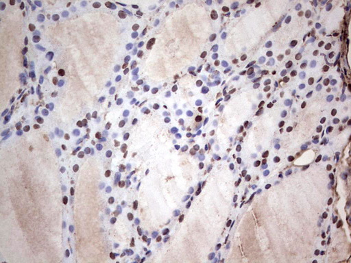 SAE1 Antibody - Immunohistochemical staining of paraffin-embedded Human thyroid tissue within the normal limits using anti-SAE1 mouse monoclonal antibody. (Heat-induced epitope retrieval by 1 mM EDTA in 10mM Tris, pH8.5, 120C for 3min,