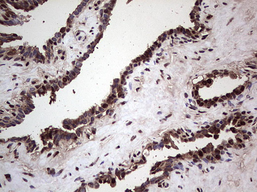SAE1 Antibody - Immunohistochemical staining of paraffin-embedded Human prostate tissue within the normal limits using anti-SAE1 mouse monoclonal antibody. (Heat-induced epitope retrieval by 1 mM EDTA in 10mM Tris, pH8.5, 120C for 3min,