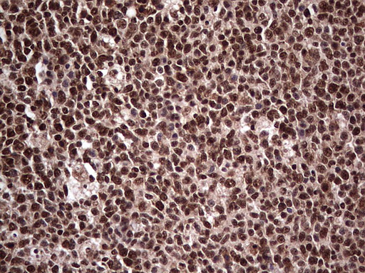 SAE1 Antibody - Immunohistochemical staining of paraffin-embedded Human tonsil within the normal limits using anti-SAE1 mouse monoclonal antibody. (Heat-induced epitope retrieval by 1 mM EDTA in 10mM Tris, pH8.5, 120C for 3min,