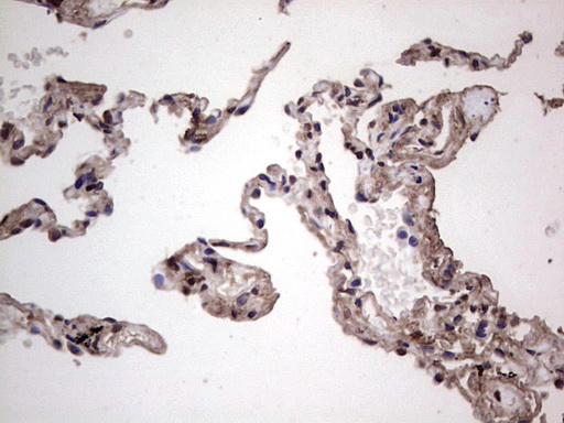 SAE1 Antibody - Immunohistochemical staining of paraffin-embedded Human lung tissue within the normal limits using anti-SAE1 mouse monoclonal antibody. (Heat-induced epitope retrieval by 1 mM EDTA in 10mM Tris, pH8.5, 120C for 3min,