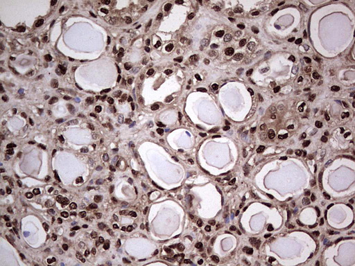 SAE1 Antibody - IHC of paraffin-embedded Human Kidney tissue using anti-SAE1 mouse monoclonal antibody. (Heat-induced epitope retrieval by 1 mM EDTA in 10mM Tris, pH8.5, 120°C for 3min).