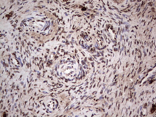 SAE1 Antibody - IHC of paraffin-embedded Human Ovary tissue using anti-SAE1 mouse monoclonal antibody. (Heat-induced epitope retrieval by 1 mM EDTA in 10mM Tris, pH8.5, 120°C for 3min).