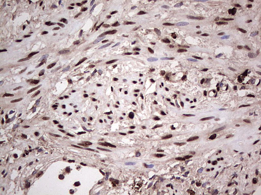 SAE1 Antibody - IHC of paraffin-embedded Human endometrium tissue using anti-SAE1 mouse monoclonal antibody. (Heat-induced epitope retrieval by 1 mM EDTA in 10mM Tris, pH8.5, 120°C for 3min).