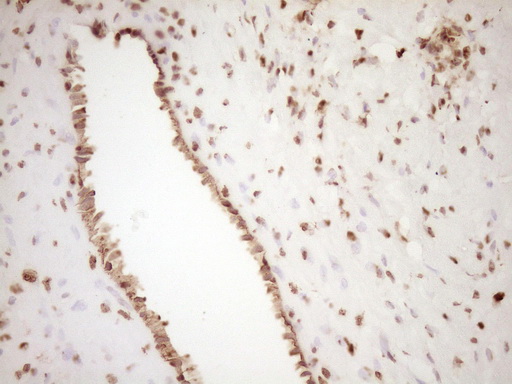 SAE1 Antibody - Immunohistochemical staining of paraffin-embedded Human Ovary tissue within the normal limits using anti-SAE1 mouse monoclonal antibody. (Heat-induced epitope retrieval by 1 mM EDTA in 10mM Tris, pH8.5, 120C for 3min,