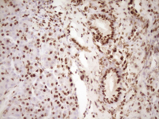 SAE1 Antibody - Immunohistochemical staining of paraffin-embedded Human pancreas tissue within the normal limits using anti-SAE1 mouse monoclonal antibody. (Heat-induced epitope retrieval by 1 mM EDTA in 10mM Tris, pH8.5, 120C for 3min,