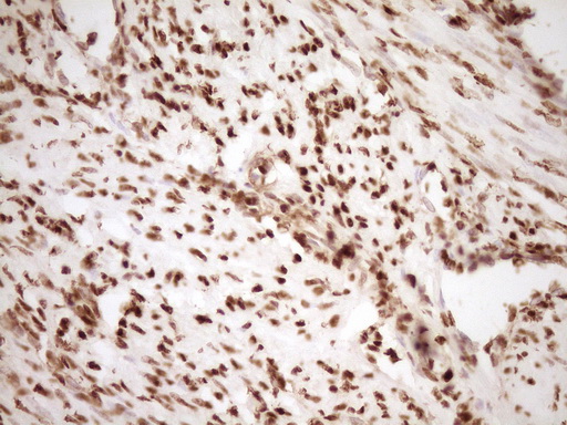 SAE1 Antibody - Immunohistochemical staining of paraffin-embedded Human endometrium tissue within the normal limits using anti-SAE1 mouse monoclonal antibody. (Heat-induced epitope retrieval by 1 mM EDTA in 10mM Tris, pH8.5, 120C for 3min,
