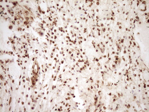 SAE1 Antibody - Immunohistochemical staining of paraffin-embedded Human lymph node tissue within the normal limits using anti-SAE1 mouse monoclonal antibody. (Heat-induced epitope retrieval by 1 mM EDTA in 10mM Tris, pH8.5, 120C for 3min,