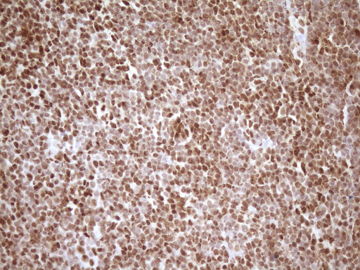 SAE1 Antibody - Immunohistochemical staining of paraffin-embedded Human tonsil within the normal limits using anti-SAE1 mouse monoclonal antibody. (Heat-induced epitope retrieval by 1 mM EDTA in 10mM Tris, pH8.5, 120C for 3min,