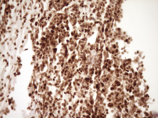 SAE1 Antibody - Immunohistochemical staining of paraffin-embedded Human colon tissue within the normal limits using anti-SAE1 mouse monoclonal antibody. (Heat-induced epitope retrieval by 1 mM EDTA in 10mM Tris, pH8.5, 120C for 3min,