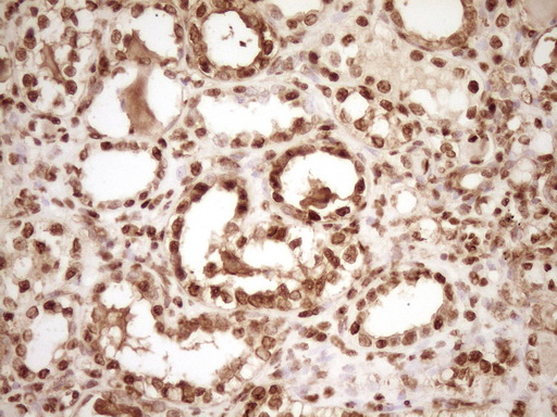 SAE1 Antibody - Immunohistochemical staining of paraffin-embedded Human Kidney tissue within the normal limits using anti-SAE1 mouse monoclonal antibody. (Heat-induced epitope retrieval by 1 mM EDTA in 10mM Tris, pH8.5, 120C for 3min,