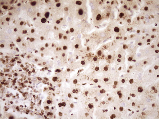 SAE1 Antibody - Immunohistochemical staining of paraffin-embedded Human liver tissue within the normal limits using anti-SAE1 mouse monoclonal antibody. (Heat-induced epitope retrieval by 1 mM EDTA in 10mM Tris, pH8.5, 120C for 3min,