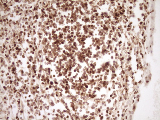 SAE1 Antibody - IHC of paraffin-embedded Human thyroid tissue using anti-SAE1 mouse monoclonal antibody. (Heat-induced epitope retrieval by 1 mM EDTA in 10mM Tris, pH8.5, 120°C for 3min).