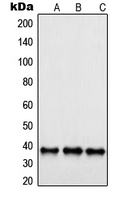 SAE1 Antibody - Western blot analysis of SAE1 expression in Jurkat (A); A431 (B); HeLa (C) whole cell lysates.