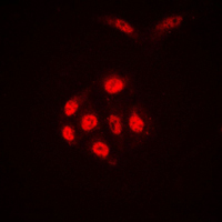SAE1 Antibody - Immunofluorescent analysis of SAE1 staining in A431 cells. Formalin-fixed cells were permeabilized with 0.1% Triton X-100 in TBS for 5-10 minutes and blocked with 3% BSA-PBS for 30 minutes at room temperature. Cells were probed with the primary antibody in 3% BSA-PBS and incubated overnight at 4 C in a humidified chamber. Cells were washed with PBST and incubated with a DyLight 594-conjugated secondary antibody (red) in PBS at room temperature in the dark. DAPI was used to stain the cell nuclei (blue).