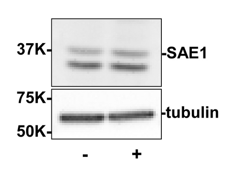 SAE1 Antibody - Western blot of Rabbit anti-SAE1 antibody shows detection of SAE1. Left lane (-) contains 20 ug human HeLa whole cell protein. Right lane (+) contains 20 ug human HeLa whole cell protein from cells pre-treated with phosphatase inhibitor cocktail to prevent dephosphorylation of the target. Proteins were separated on a 10% SDS-PAGE and transferred onto nitrocellulose. After blocking with 5% milk-TBST 1 hr at room temperature, the membrane was probed with the primary antibody, Anti-SAE1, diluted to 2 g/mL at room temperature for 3 hr followed by washes and reaction with HRP-conjugated secondary and ECL imaging. Personal communication, Xin-Hua Feng, Baylor College of Medicine, Houstin, TX.