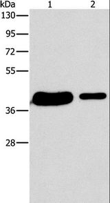 SAE1 Antibody - Western blot analysis of 293T and A431 cell, using SAE1 Polyclonal Antibody at dilution of 1:400.