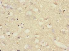 SAE1 Antibody - Immunohistochemistry of paraffin-embedded human brain tissue at dilution 1:100