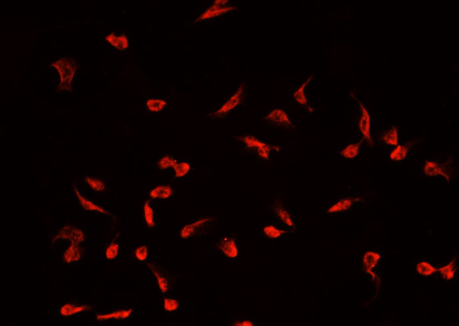 SAE1 Antibody - Staining 293 cells by IF/ICC. The samples were fixed with PFA and permeabilized in 0.1% Triton X-100, then blocked in 10% serum for 45 min at 25°C. The primary antibody was diluted at 1:200 and incubated with the sample for 1 hour at 37°C. An Alexa Fluor 594 conjugated goat anti-rabbit IgG (H+L) Ab, diluted at 1/600, was used as the secondary antibody.