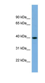 SAE1 Antibody - SAE1 antibody Western blot of Fetal Brain lysate. This image was taken for the unconjugated form of this product. Other forms have not been tested.