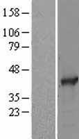 SAE1 Protein - Western validation with an anti-DDK antibody * L: Control HEK293 lysate R: Over-expression lysate