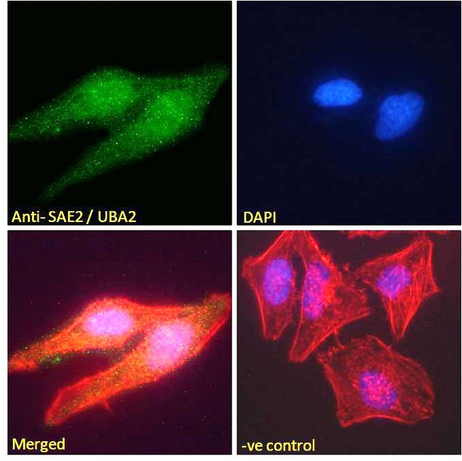 SAE2 / UBA2 Antibody - SAE2 / UBA2 antibody immunofluorescence analysis of paraformaldehyde fixed HeLa cells, permeabilized with 0.15% Triton. Primary incubation 1hr (10ug/ml) followed by Alexa Fluor 488 secondary antibody (2ug/ml), showing nuclear and weak cytoplasmic weak staining. Actin filaments were stained with phalloidin (red) and the nuclear stain is DAPI (blue). Negative control: Unimmunized goat IgG (10ug/ml) followed by Alexa Fluor 488 secondary antibody (2ug/ml).