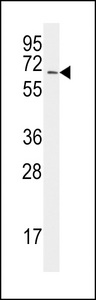 SAE2 / UBA2 Antibody - The anti-UBA2 C-term E616 Antibody is used in Western blot to detect UBA2 in Jurkat lysate.