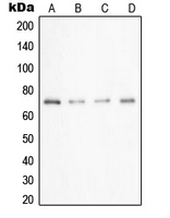 SAE2 / UBA2 Antibody - Western blot analysis of UBA2 expression in A549 (A); Caco2 (B); HeLa (C); HepG2 (D) whole cell lysates.