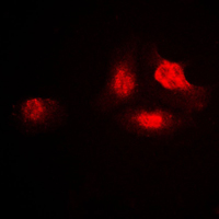 SAE2 / UBA2 Antibody - Immunofluorescent analysis of UBA2 staining in A549 cells. Formalin-fixed cells were permeabilized with 0.1% Triton X-100 in TBS for 5-10 minutes and blocked with 3% BSA-PBS for 30 minutes at room temperature. Cells were probed with the primary antibody in 3% BSA-PBS and incubated overnight at 4 C in a humidified chamber. Cells were washed with PBST and incubated with a DyLight 594-conjugated secondary antibody (red) in PBS at room temperature in the dark. DAPI was used to stain the cell nuclei (blue).