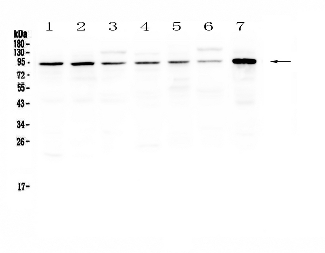 SAE2 / UBA2 Antibody - Western blot - Anti-SAE2/UBA2 Picoband antibody