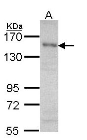 SAFB1 / SAFB Antibody - Sample (30 ug of whole cell lysate). A: A431 , B: Hep G2 . 7.5% SDS PAGE. SAFB1 / SAFB antibody diluted at 1:1000.