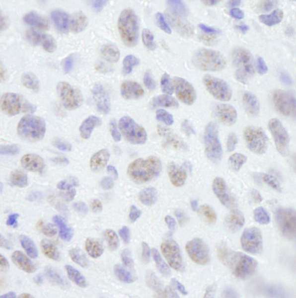 SAFB1 / SAFB Antibody - Detection of Mouse SAFB1 by Immunohistochemistry. Sample: FFPE section of mouse squamous cell carcinoma. Antibody: Affinity purified rabbit anti-SAFB1 used at a dilution of 1:250.