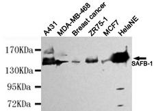 SAFB1 / SAFB Antibody - Western blot detection of SAFB-1 in HeLa NE,A431,MDA-MB-468,Breast cancer,ZR75-1&MCF7 cell lysates using SAFB-1 antibody (1:4000 diluted).
