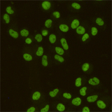 SAFB1 / SAFB Antibody - Immunocytochemistry staining of HeLa cells fixed with 4% Paraformaldehyde and using SAFB1 mouse monoclonal antibody (dilution 1:200).